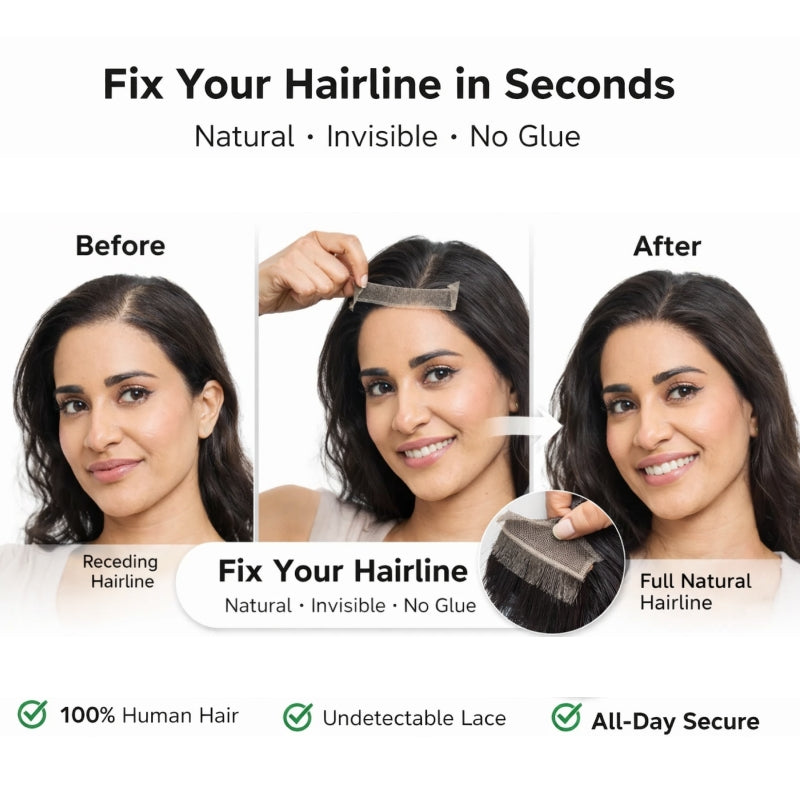🔥🔥Instantly Fix Your Hairline — No One Will Ever Know
