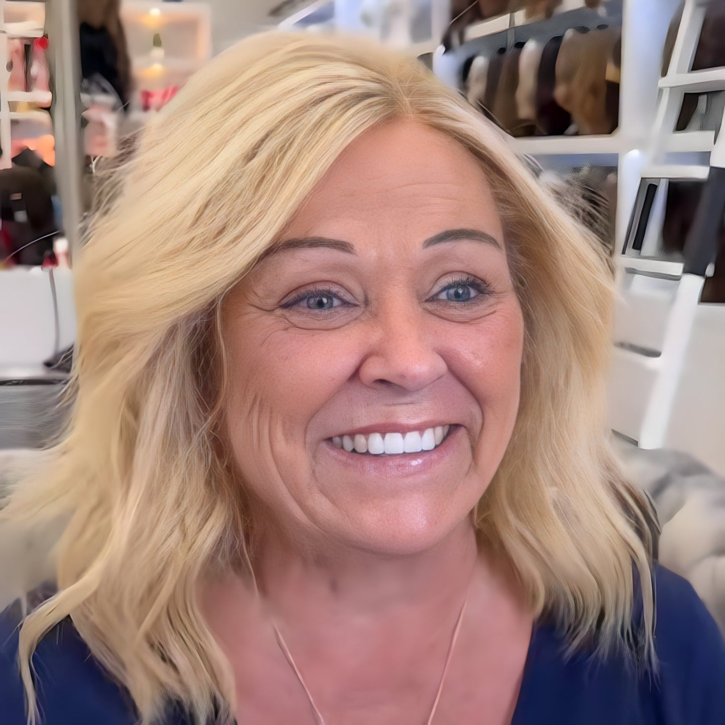 ❤️❤️ Instantly Fix Your Hairline — No One Will Ever Know